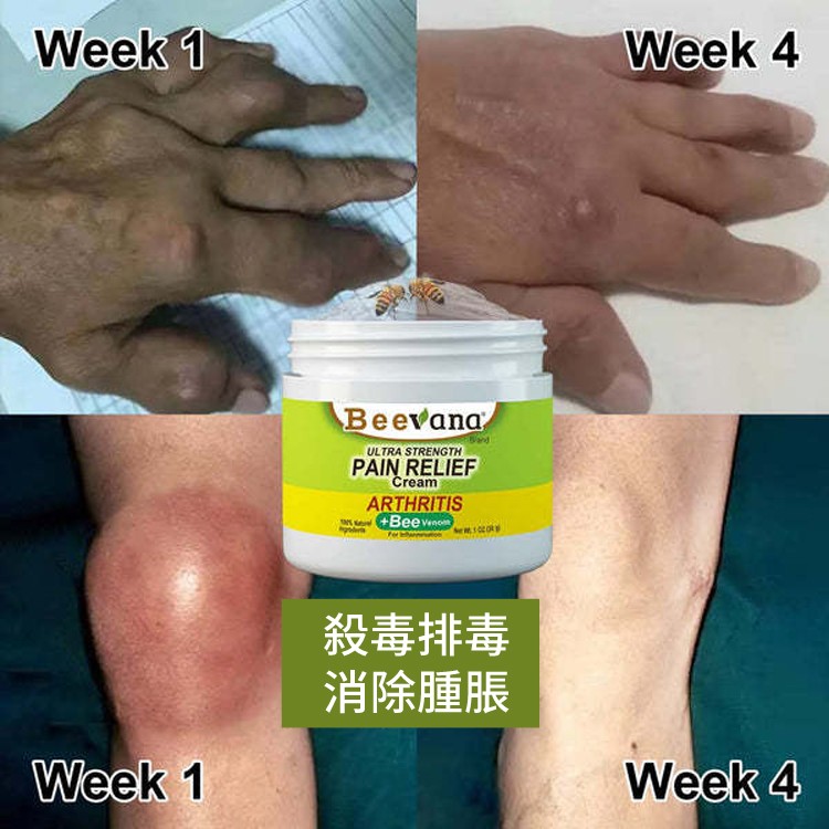 蜂毒關節霜#關節疼痛，#腫脹，全面護理 塗一塗告別疼痛 ☑損傷疼痛☑腫脹變形☑風濕骨痛