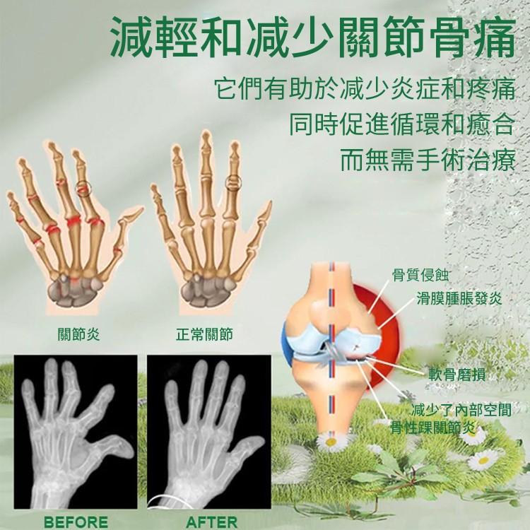 蜂毒關節霜#關節疼痛，#腫脹，全面護理 塗一塗告別疼痛 ☑損傷疼痛☑腫脹變形☑風濕骨痛