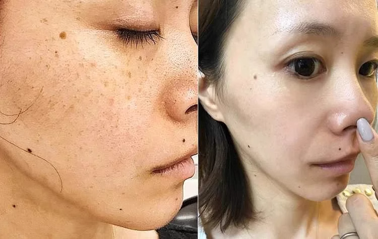 1718260754870827.png 9cb12600b8812de82a2321bad97a25a.png